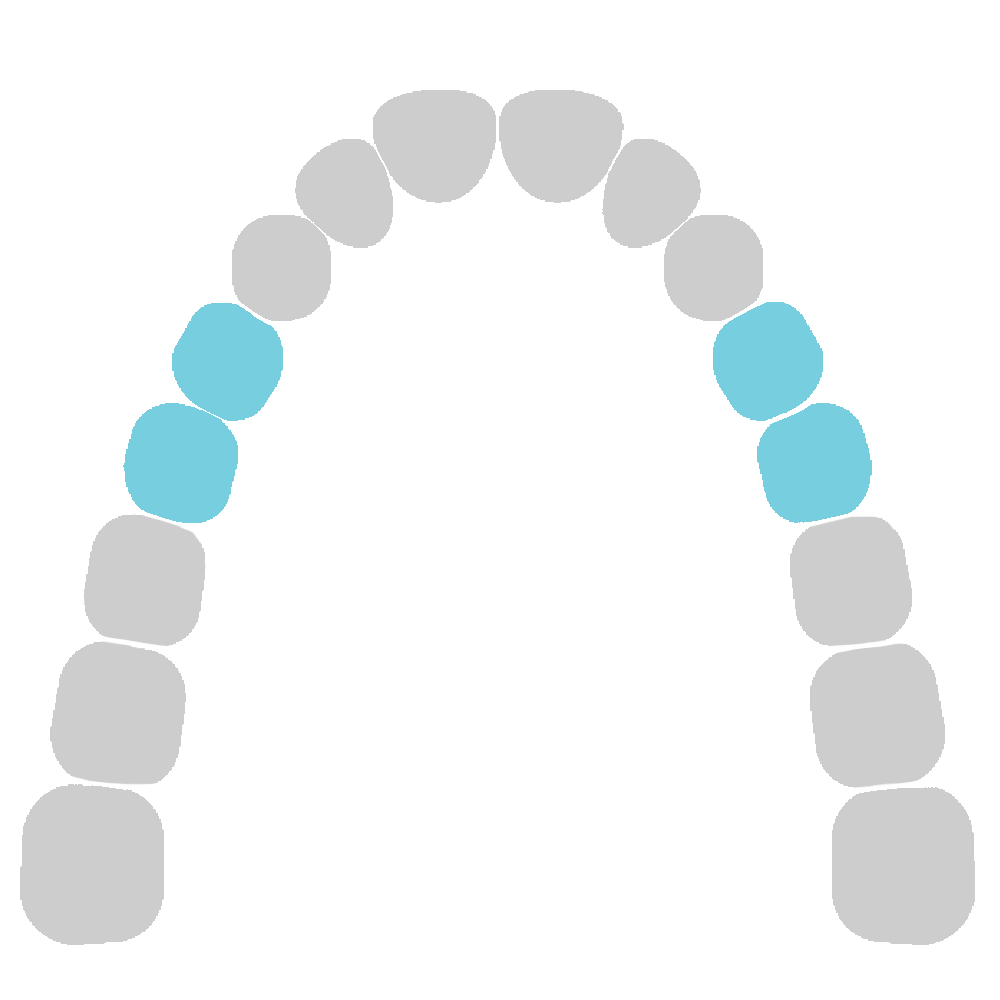 Upper Jaw - Bicuspids