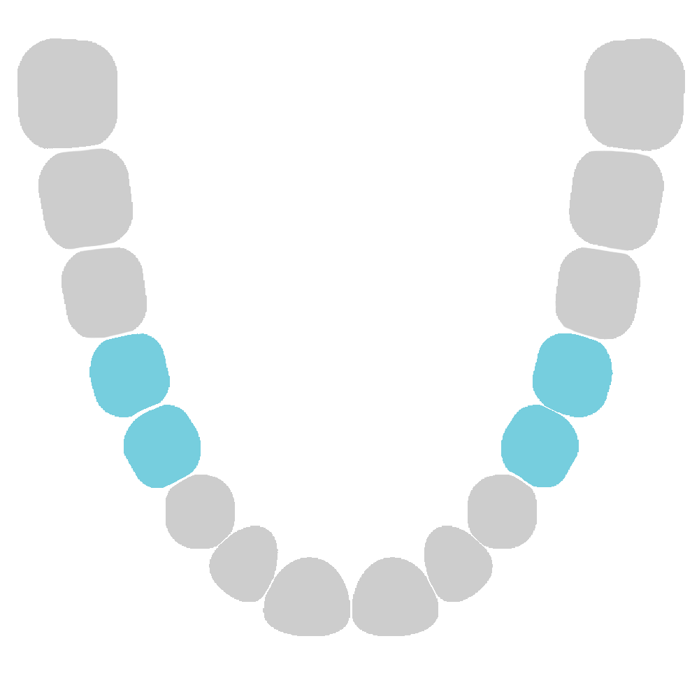 Lower molars