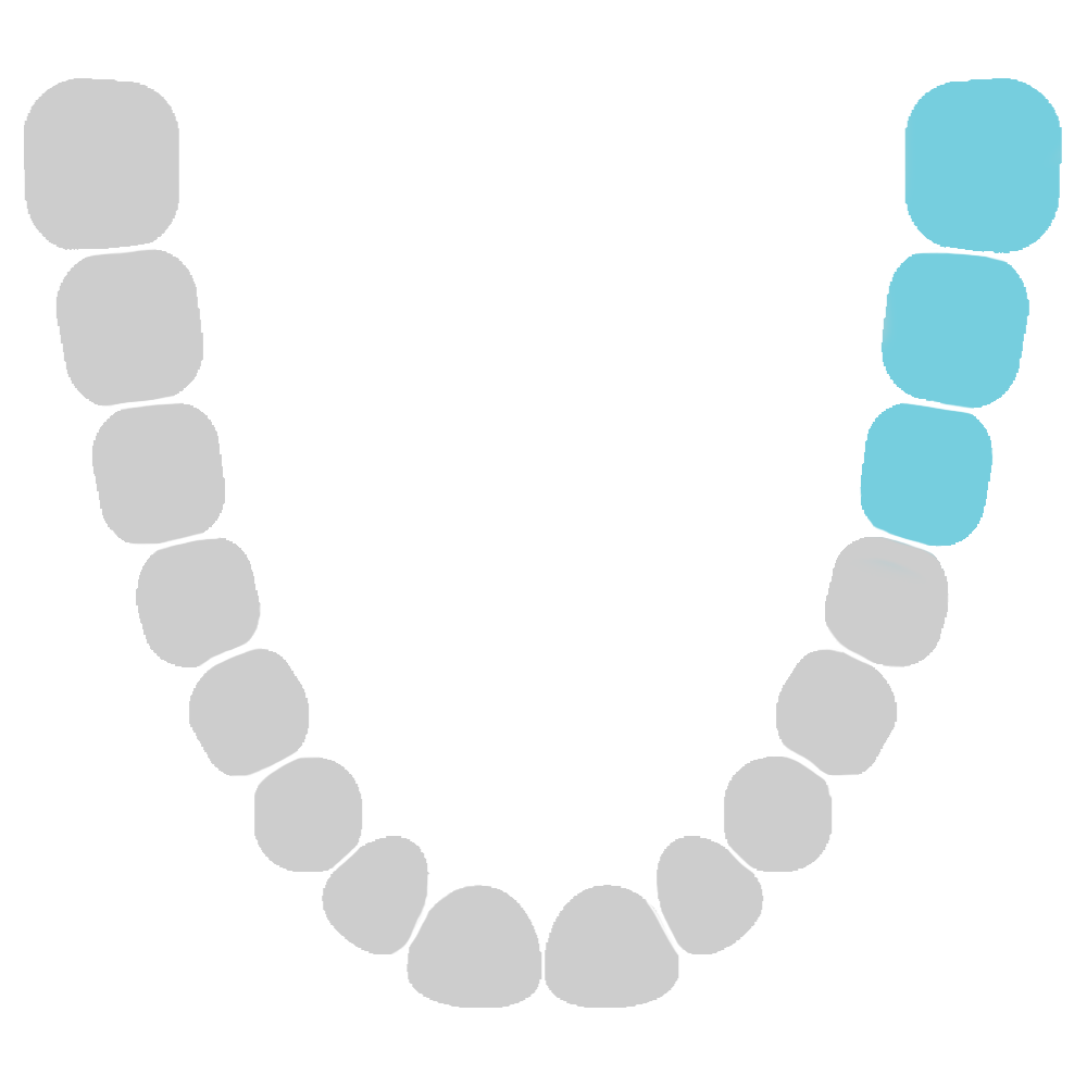 Colour-Coded-Gob_-_LOWER_BACK_LEFT