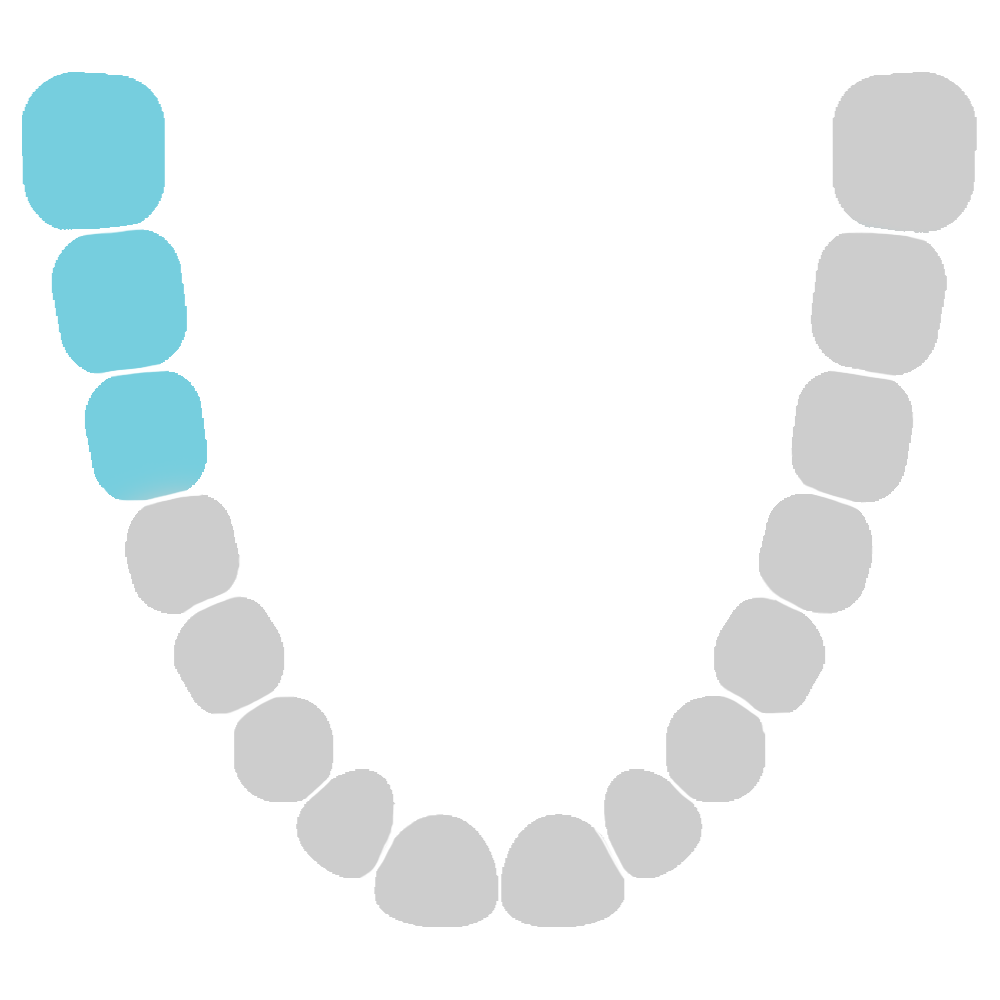 Lower molar teeth diagram