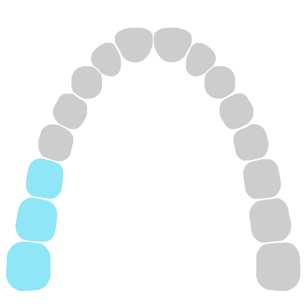 6,7,8 right diagram