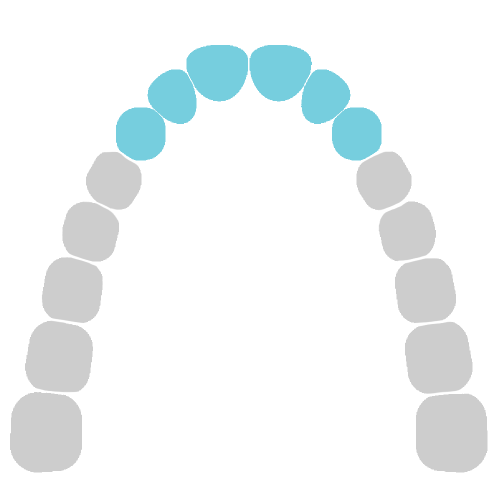 Upper Jaw - Incisors and cuspids