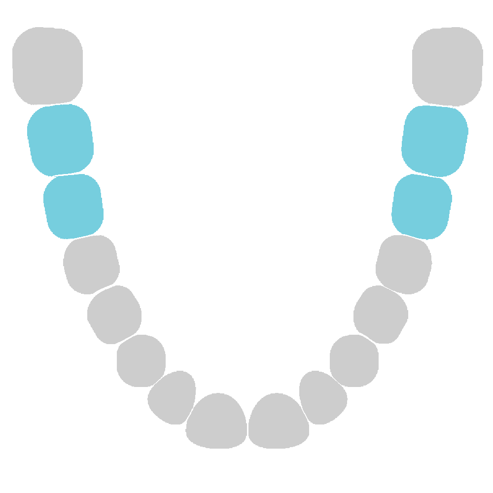 Lower Jaw - Molars