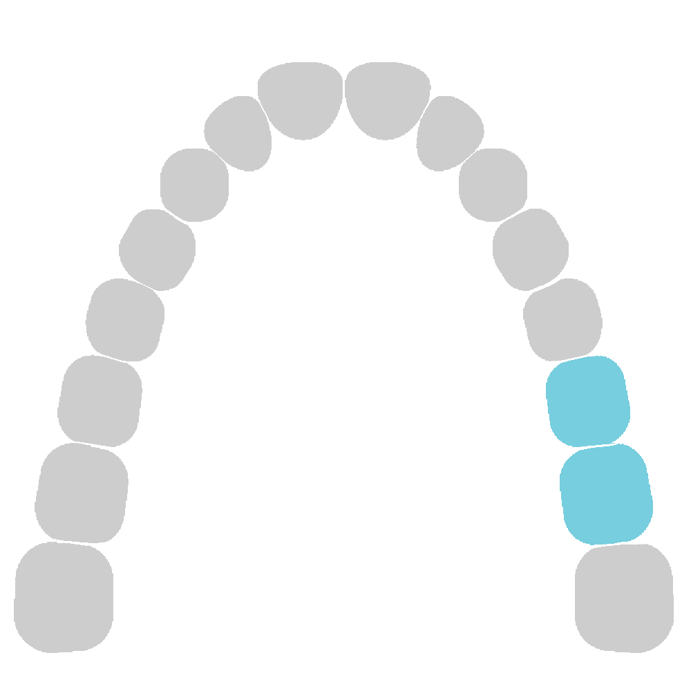 Left Molars