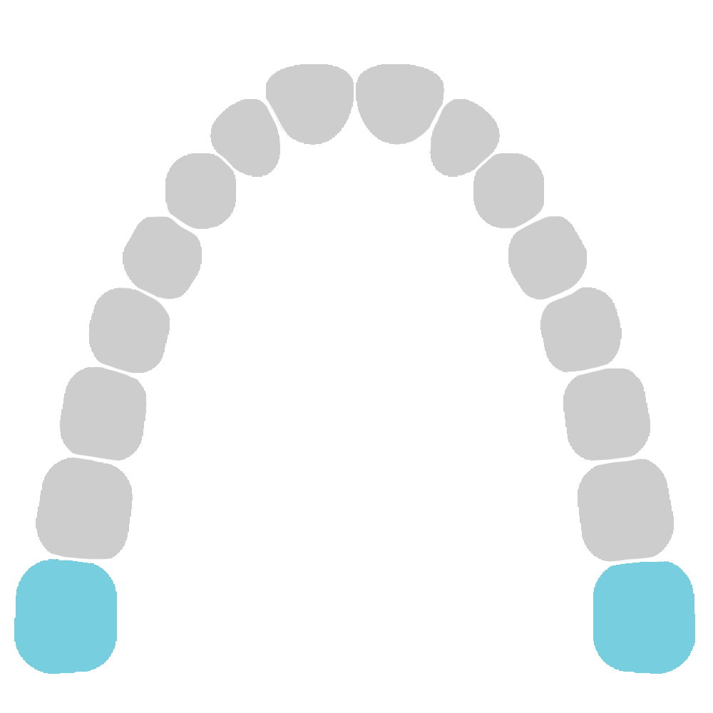 Upper third molars