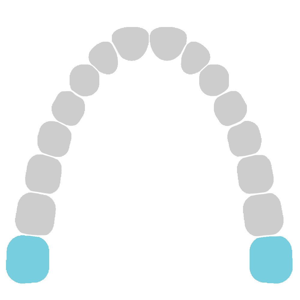 Third Molars