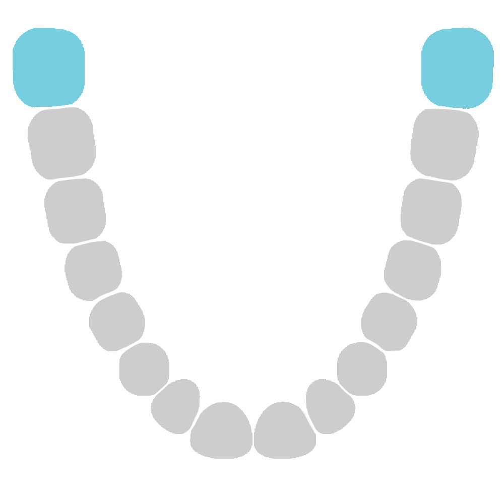 Third Molars - Lower Jaw