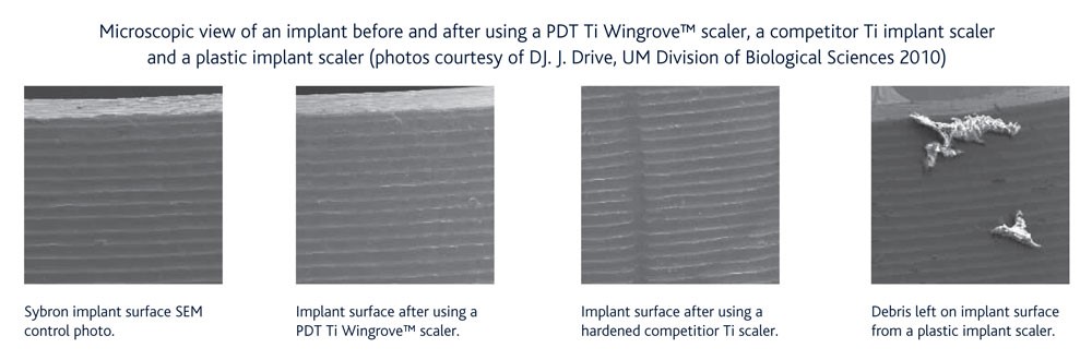 Microscopic view of an implant before and after using a PDT Ti Wingrove scaler