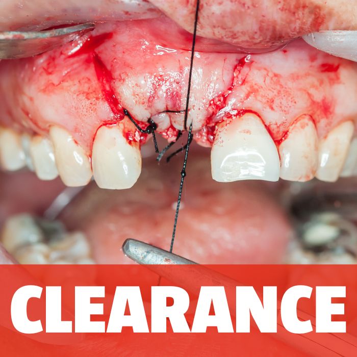 Suture Clearance