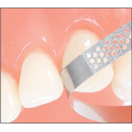 Edenta PCXDS2 Single Side Coated Perforated Diamond Finishing Strips, Serrated, 2.5mm. Demo