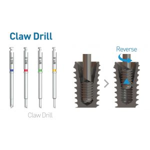 Neobiotech Claw Drill for Screw Removal Kit