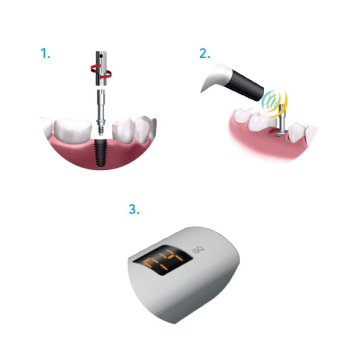 Dental Implant Stability Meter (ISQ) – Monitor Osseointegration, FDA K163414, Fast Shipping