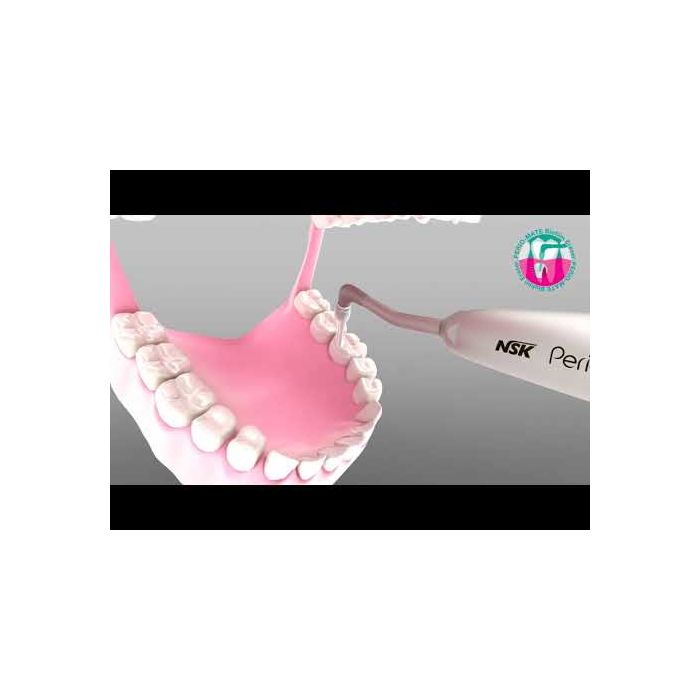 Dental Polisher Nozzle FitWith NSK Air Bien Dental Polisher Hygiene ...