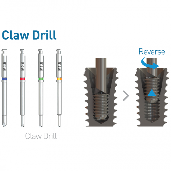 Dental Screw Remover Kit - Implant Claw Reverse Drill Guide Driver For Dentistry & Orthodontics