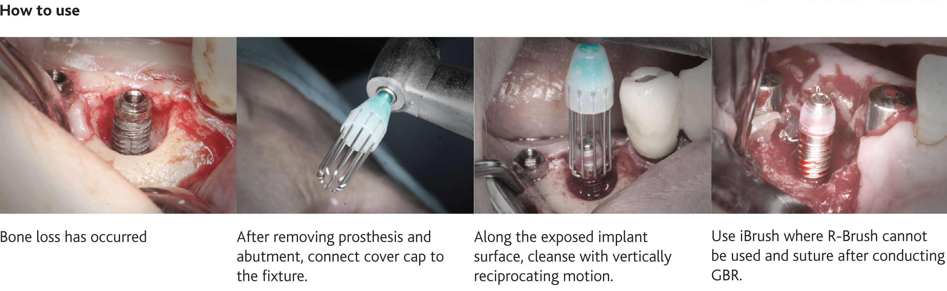How to use the R-Brush