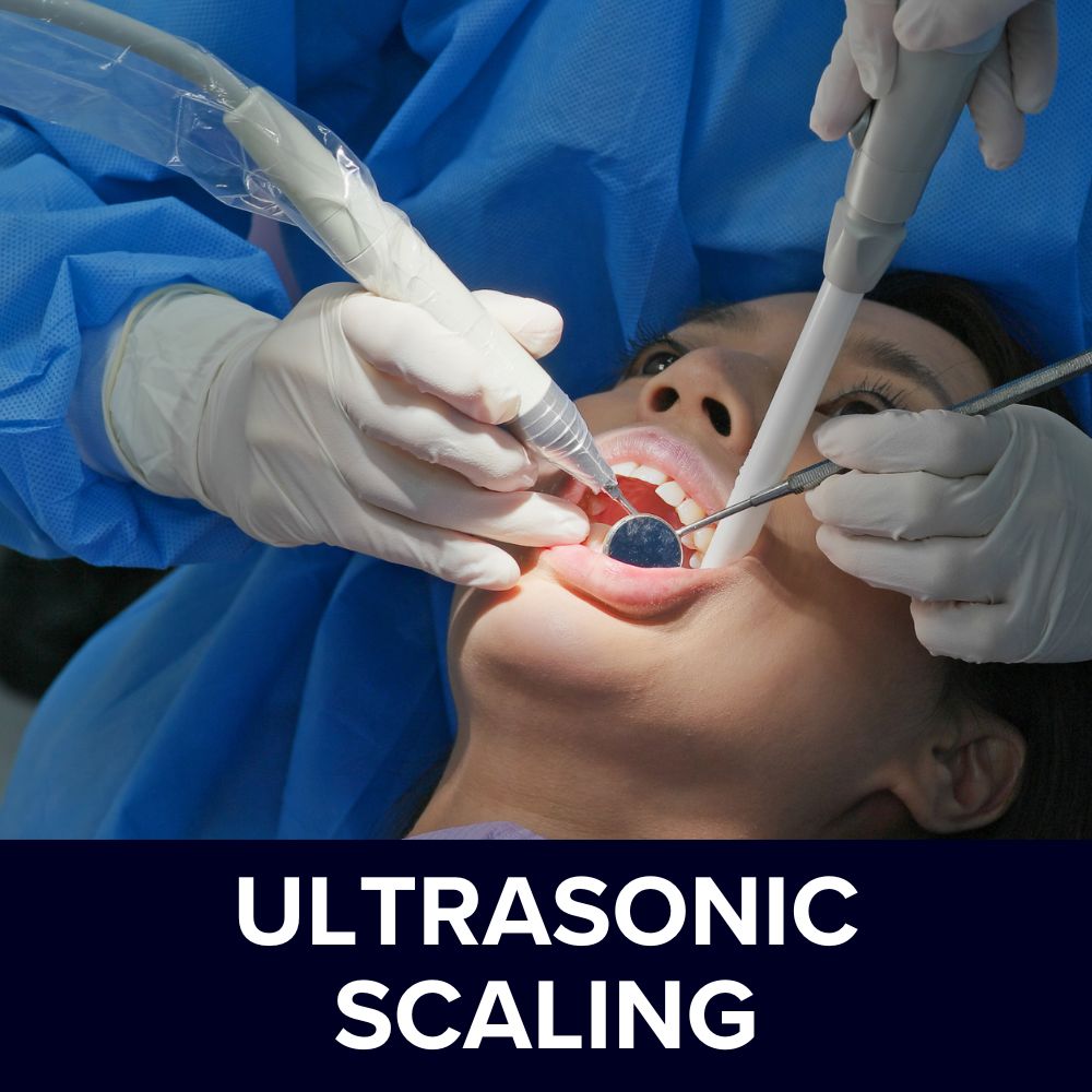 Ultrasonic Scaling