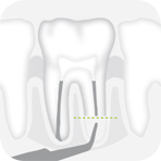 W&H Piezomed Tooth illustration