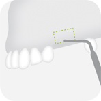 W&H Piezomed Tooth illustration